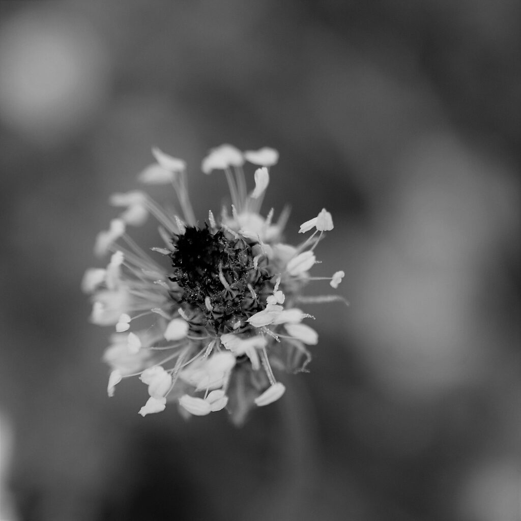 頭皮に最適な化粧水の抗炎症成分とは？